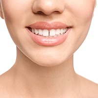Person with gapped teeth