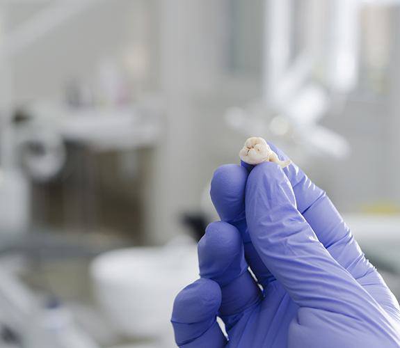 Up-close image of an extracted tooth in a gloved hand