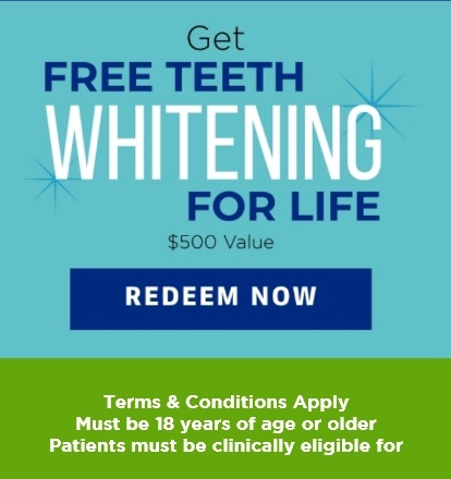 free teeth whitening for life