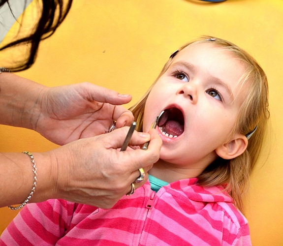 Little girl about to receive a dental cleaning