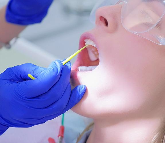 Child receiving fluoride treatment