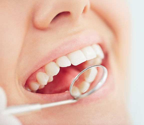 Dentist checking patient's tooth colored fillings during restorative dentistry treatment