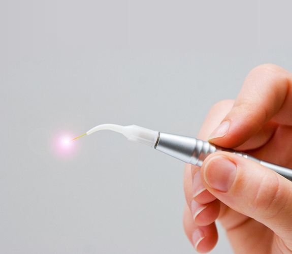 Soft tissue laser dentistry