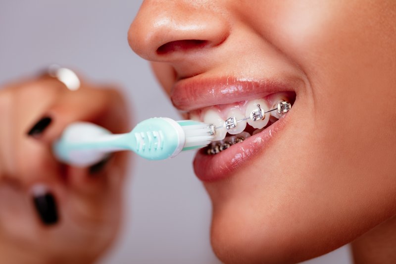 Woman with braces brushing her teeth