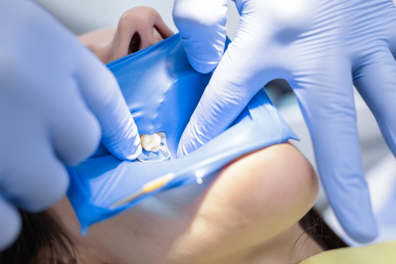 patient preparing for a root canal